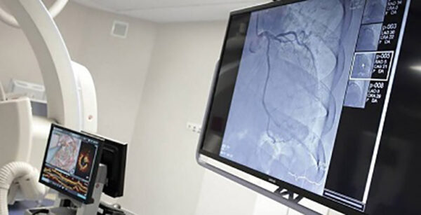 La Regione Lazio porta la Radiologia a casa dei pazienti